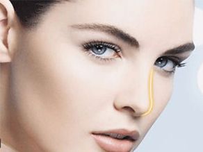 煙臺(tái)曹品根醫(yī)生的雙眼皮修復(fù)經(jīng)驗(yàn)揭秘，90天修復(fù)案例全記錄