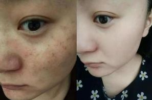 全國治療拉皮手術(shù)頗具實力的整形醫(yī)院公布：排名之選非他莫屬！