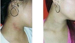 全國各大醫(yī)院推薦！拉皮手術(shù)高水平醫(yī)院盤點