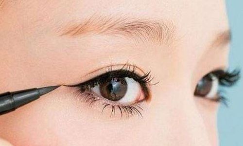 看趙成利的真人雙眼皮案例圖，驚艷線條自然流暢