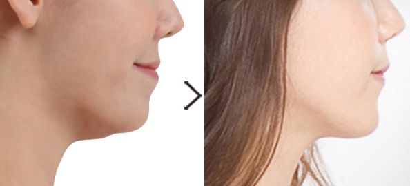 整形美容院選擇指南：華美、珍潤、藍山等品牌綜合比較，價格一覽表！