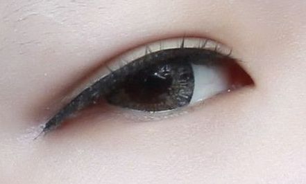 中國(guó)醫(yī)學(xué)科學(xué)院整形外科醫(yī)院專家侯典舉詳解脂肪面填術(shù)，成功案例披露！