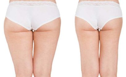 驚喜來襲！武漢葉子醫(yī)療美容醫(yī)院帶來全新鼻子塑造效果圖！