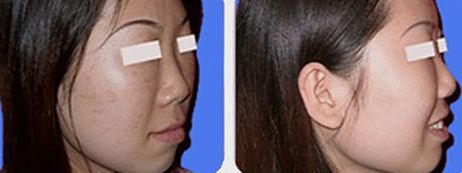 上海九院某醫(yī)生空前火爆！有幸親歷他的高超吸脂術(shù)！價(jià)格一覽來啦！