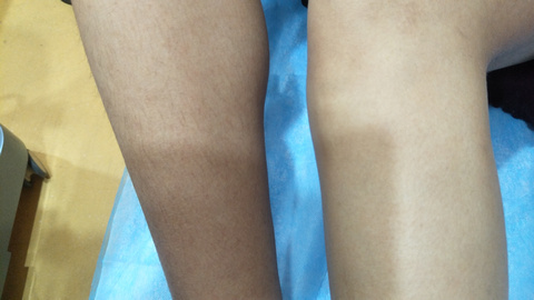 湘西自治州人民醫(yī)院燒傷美容整形科是否能滿足療效和口碑的雙重期望？有哪些備受推崇的醫(yī)生值得推薦？