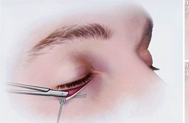 鼻部整形專家推薦：北京伊萊美哪位醫(yī)生技術(shù)一流？王冀耕、李旭東等好評如潮！