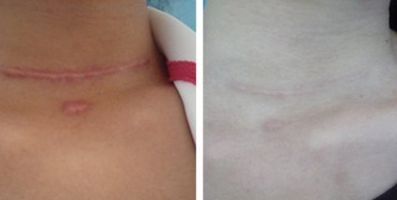 461醫(yī)院的口腔科-獨(dú)特的牙科解決方案涵蓋種植牙案例