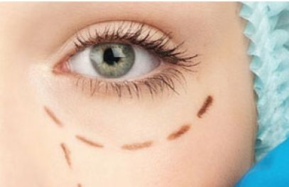 2023年首都北京近視手術(shù)醫(yī)生排行曝光！全面評估：口碑價位詳解，助你找到最佳矯正方案！