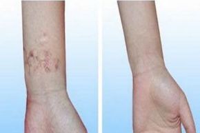 廣州地區(qū)口碑良好的植發(fā)醫(yī)院有哪些？就醫(yī)者推崇的醫(yī)院排名揭秘