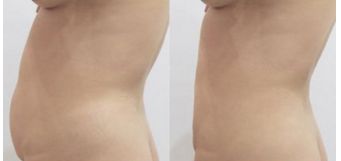 全國(guó)鼻子整形醫(yī)院排名揭曉，這幾家醫(yī)院上榜！