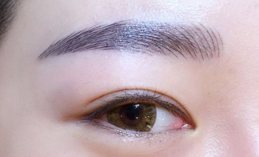 徐利剛：杭州藝星整形臨床實(shí)力派！鼻子整形解析，案例詳解！