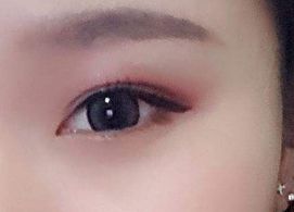 蔣小花醫(yī)生手術(shù)的實際操作方法和評價分享，多樣風(fēng)格消解揭秘！