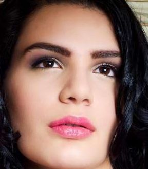 王太玲雙眼皮修復(fù)前后效果展示，讓您信心重拾！