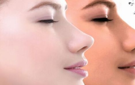 國(guó)內(nèi)十大隆鼻醫(yī)院官方認(rèn)證！精選口碑醫(yī)院，曙光、美萊等實(shí)力推薦！