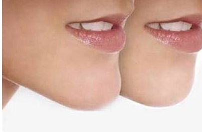 成都頂尖的玻尿酸注射醫(yī)生排行榜，六位信譽(yù)好的醫(yī)生介紹