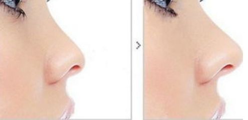 醫(yī)術(shù)精湛！感受武漢整形醫(yī)院魅力，解鎖變美新境界！