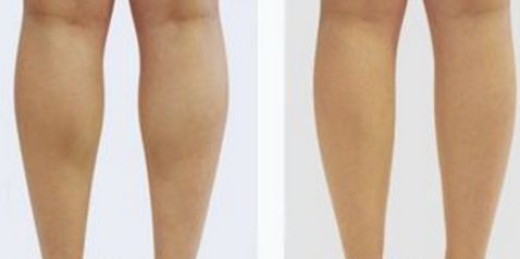 北京八大處楊欣好評傳遍朋友圈！揭秘90天顛覆性隆鼻之旅