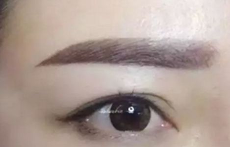 【實(shí)測(cè)】重醫(yī)長(zhǎng)慶和適度眼整：悉心選手，風(fēng)格多元！