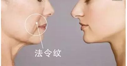 韋元強(qiáng)swan吸脂修復(fù)方法介紹，相關(guān)醫(yī)院推薦