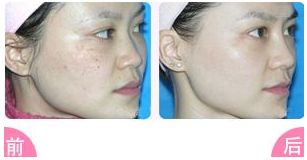 榆林二院整形科值得信賴嗎？醫(yī)生專業(yè)，雙眼皮案例豐富，收費(fèi)明明白白，專家指南！