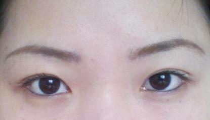 北京明會紅醫(yī)療美容診所價(jià)格表真實(shí)嗎？你會不會覺得有點(diǎn)匪夷所思？