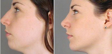 廣州熱瑪吉治療中心排行揭曉！醫(yī)院熱門榜單直擊