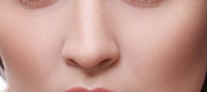 李湘源隆鼻案例，技術(shù)與反饋圖及價格表分享！