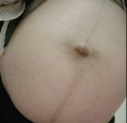 揭示濰坊市熱門(mén)隆鼻醫(yī)院排行榜！尋找濰坊隆鼻首選醫(yī)療機(jī)構(gòu)TOP10！