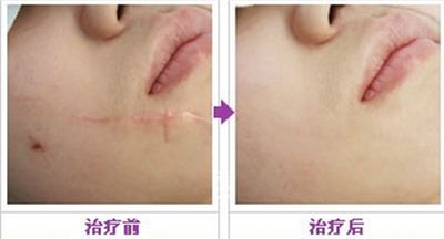 重慶神奇醫(yī)療機構(gòu)，致力于脂肪填充醫(yī)療服務(wù)的機構(gòu)盤點