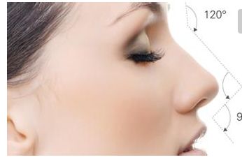 無(wú)錫二院隆鼻效果及費(fèi)用情況詳解，醫(yī)生分享成功案例