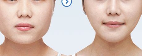 461醫(yī)院植牙科綜合評測：醫(yī)生隊伍強大，成功案例豐富，價格表詳解