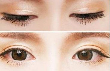 青島壹美天成整形醫(yī)院的隆鼻技術(shù)如何？看看這些真實案例！