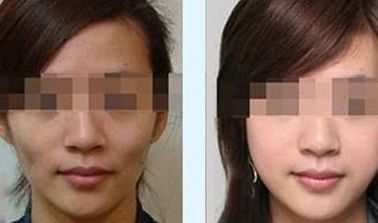 青島吸脂醫(yī)院排名及項目介紹