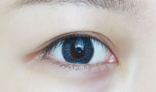 杭州超美抗皺醫(yī)院盤點(diǎn)：歐洲之星煥發(fā)年輕態(tài)