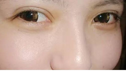 北京唇腭裂修復(fù)?？漆t(yī)院評(píng)比出爐：口碑贊譽(yù)不斷，專業(yè)正規(guī)聚焦！