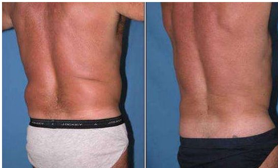 成都隆鼻專家推薦的技術(shù)排名前十，絕對讓你滿意