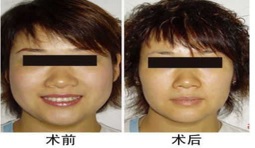 北京祛斑醫(yī)院三甲排行榜：北京哪家祛斑醫(yī)院好？