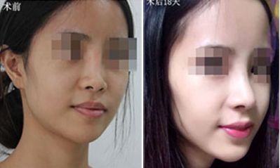 晟顏整形醫(yī)院評(píng)價(jià)及口碑如何？