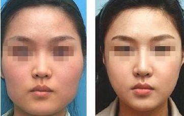 南通瘦身整形醫(yī)院哪家專業(yè)？