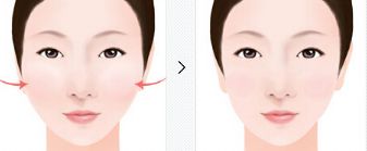 煙臺(tái)哪家整形醫(yī)院的注射效果好