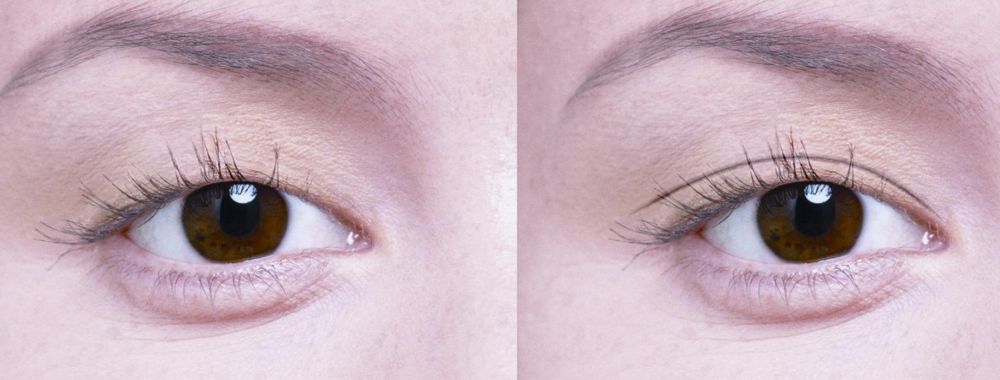 鄭州市那家醫(yī)院割雙眼皮效果好，口碑贊不絕口！