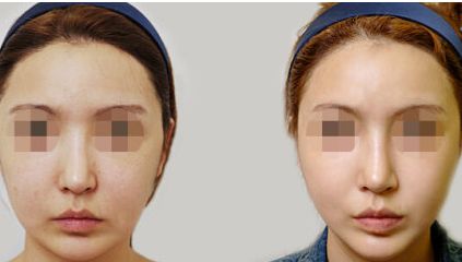 深圳七和醫(yī)美口碑如何？技術(shù)實(shí)力+醫(yī)生團(tuán)隊(duì)+特色項(xiàng)目解析