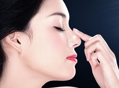 深圳隆鼻哪家好？易培金醫(yī)生經(jīng)驗口碑解析測評