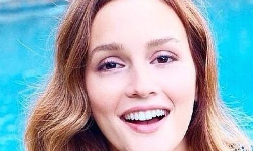 L型硅膠假體隆鼻為何不受歡迎？詳解其背后的原因