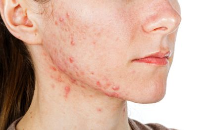 成都美容醫(yī)院醫(yī)生技術(shù)實(shí)力如何？口碑好的熱門項(xiàng)目推薦