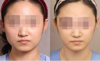 湛江有哪些頂尖整形美容醫(yī)院值得關注？