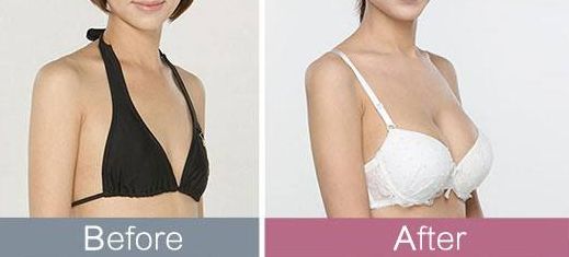 東莞哪家整形醫(yī)院頗受推薦？