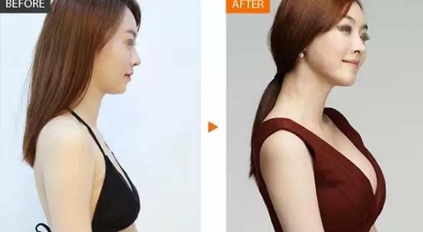 長沙哪家雙眼皮醫(yī)院排名靠前呢？