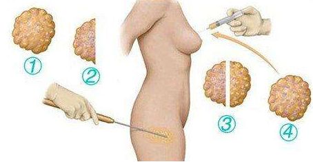 東莞華美醫(yī)療美容門診部綜合評(píng)價(jià)及價(jià)格公示