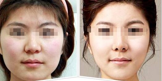 2024年廣州醫(yī)美整形醫(yī)院排行榜領軍十強